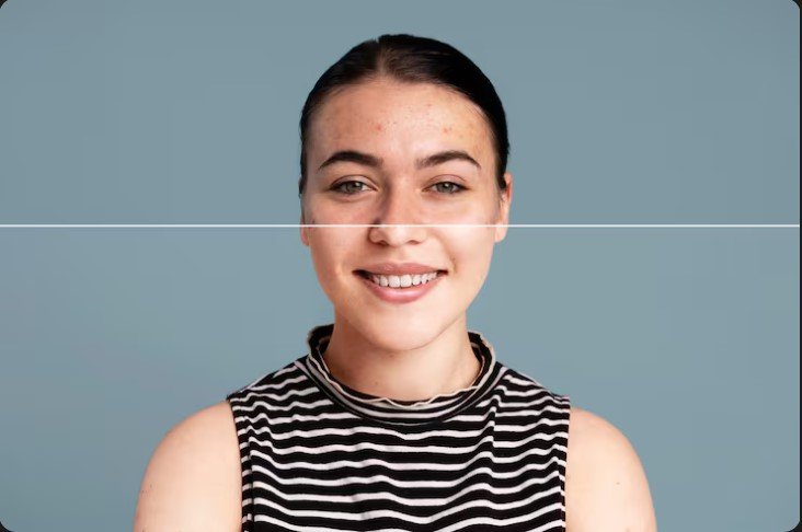 Best Doctor For Pigmentation & Acne scar Treatment In Navi Mumbai